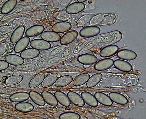 Cheilymenia stercorea (Pers. Fr.) Boud. f. stercorea